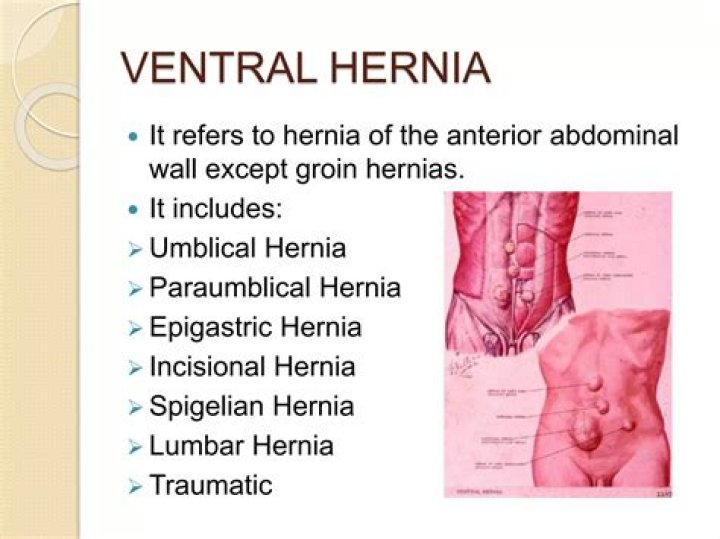 What is the most serious hernia?