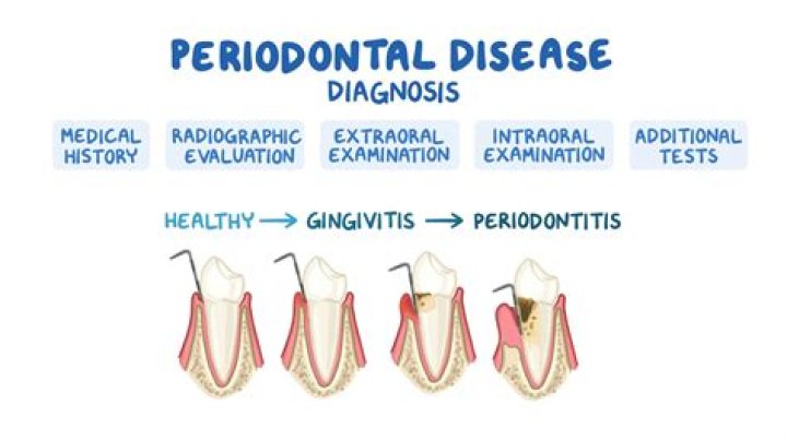 What is the prognosis for aggressive periodontitis?