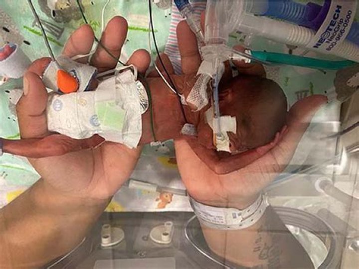 What is the youngest baby to survive?