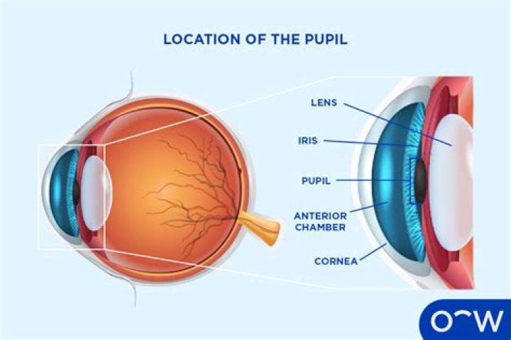 What is white pupil?