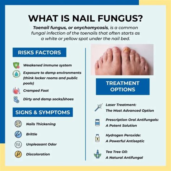 What kills toenail fungus fast?