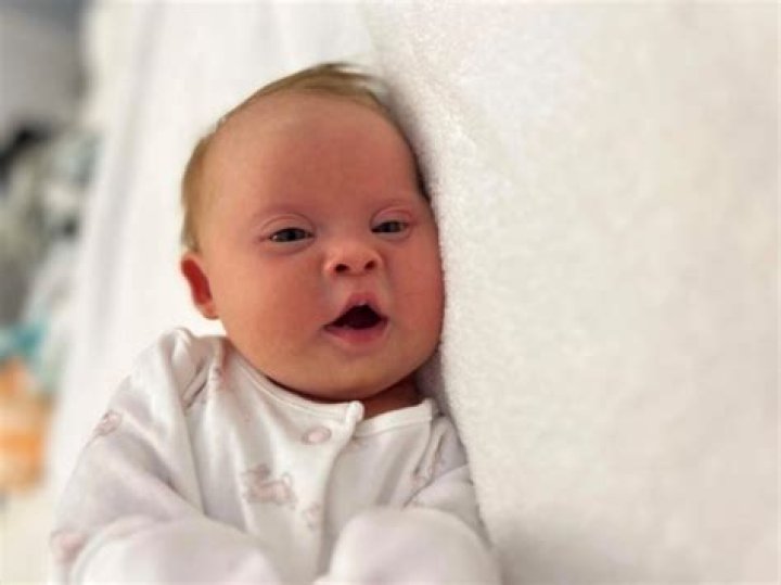 What puts you at risk for having a baby with Down syndrome?