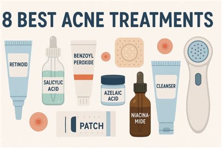 What should you not do with acne?