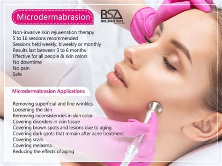 What type of skin is microdermabrasion good for?