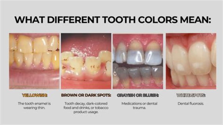 What white mineral regrows teeth?
