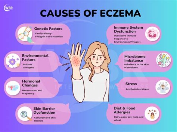 Whats causes eczema?