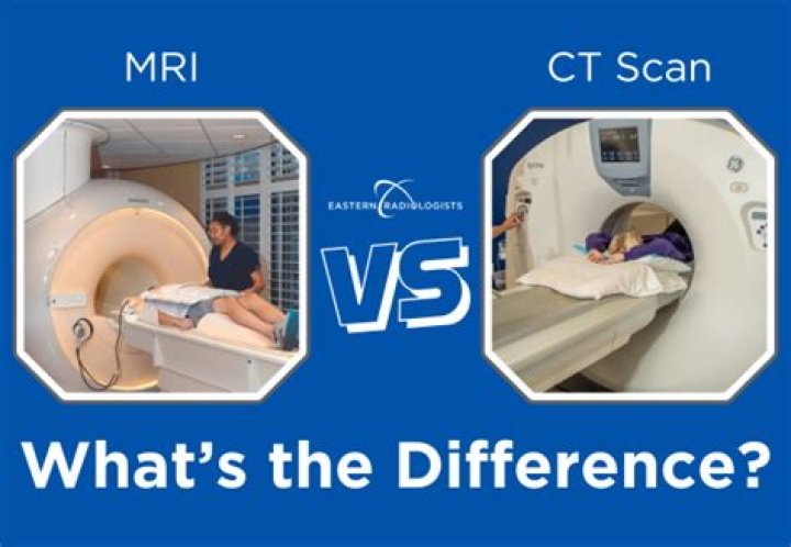 Whats the difference between a MRI scan and a CT scan?
