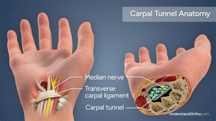 When should I see a doctor about carpal tunnel?