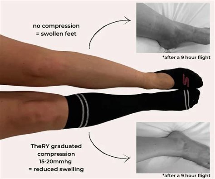 When should you not wear compression stockings?