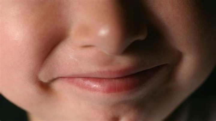 Where are your dimples?