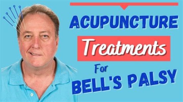 Where do you massage for Bell's palsy?