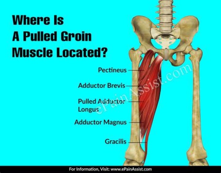 Where is a pulled groin muscle located?