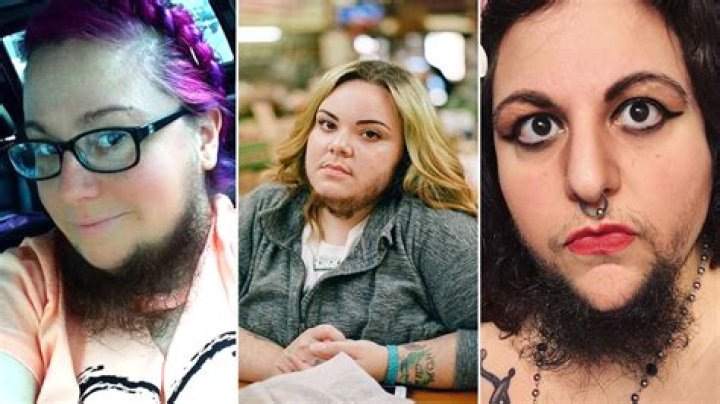 Which celebrity has PCOS?