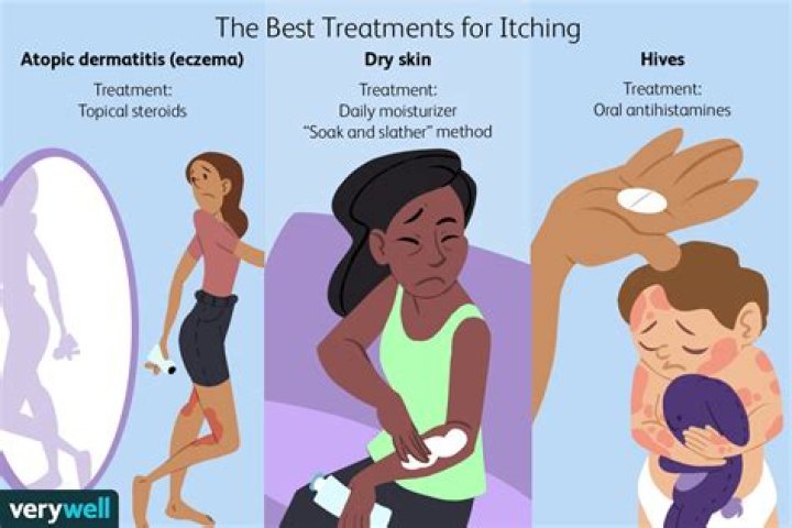 Which infection causes itching all over the body?