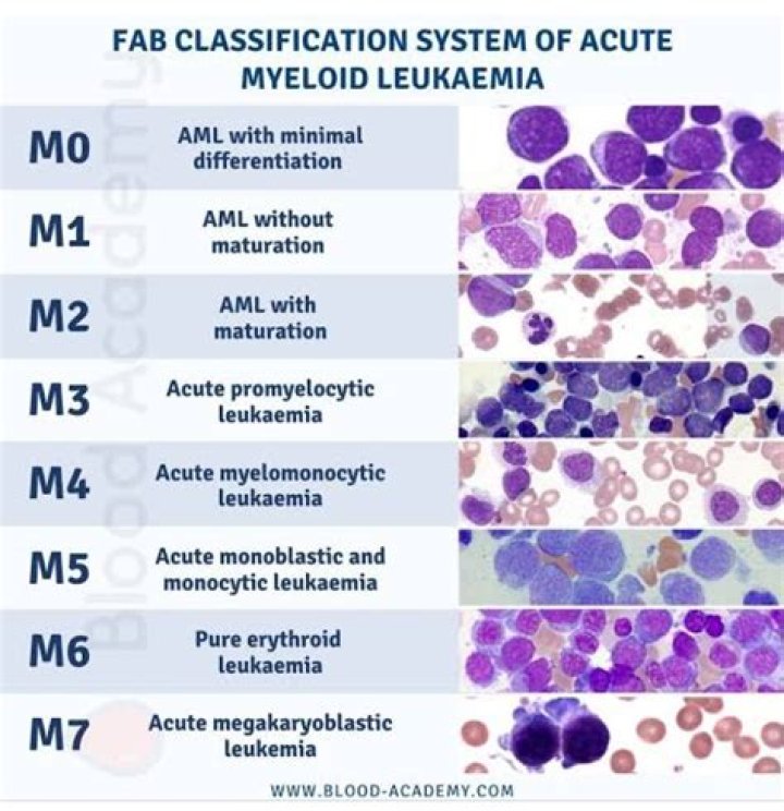 Which is worse all or AML?