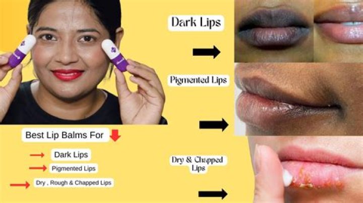 Which lip balm is best for lightening?