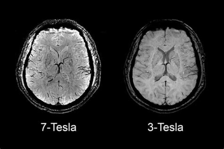 Who has a 7 tesla MRI?