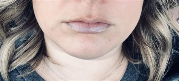 Why are my lips blue?