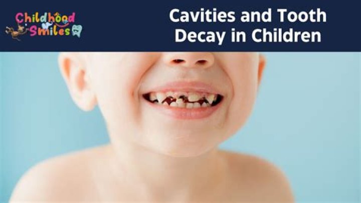 Why are my toddler's teeth decaying?