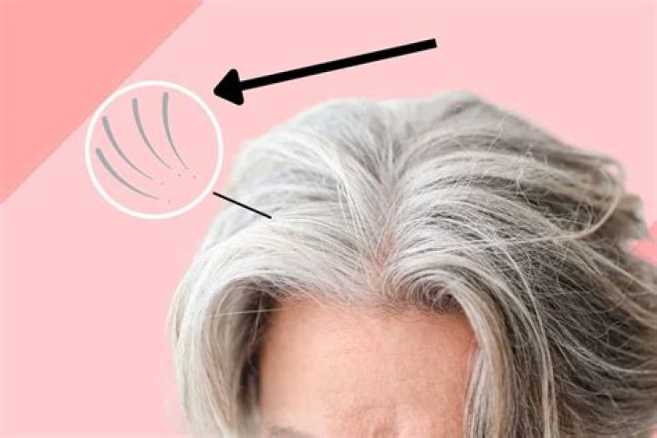 Why are white hairs harder to pull out?