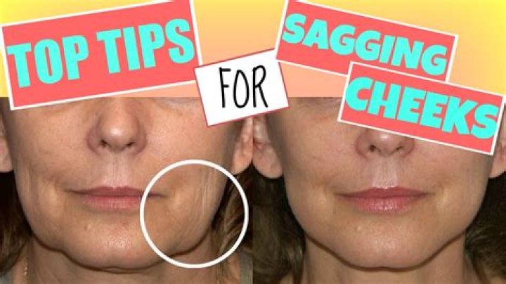 Why do cheeks sag?
