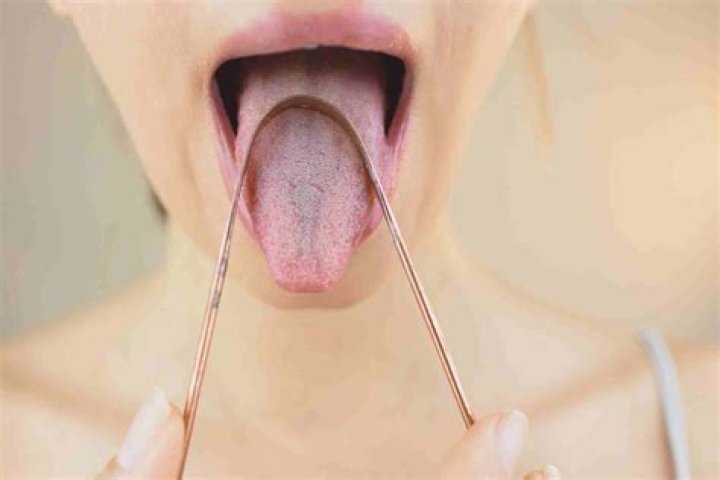 Why do I have a black spot on my tongue?