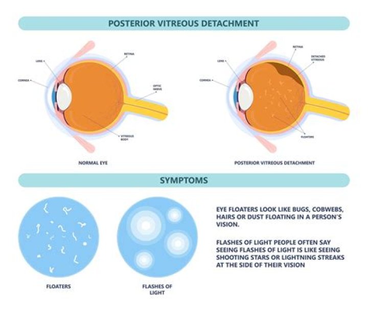 Why do I see green spots after looking at light?