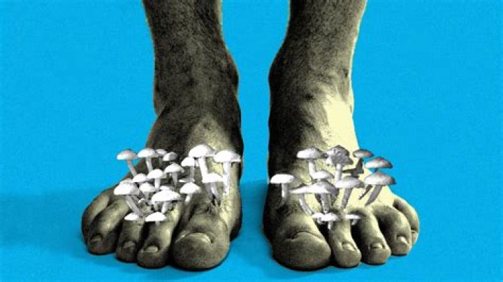 Why do I stink after surgery?