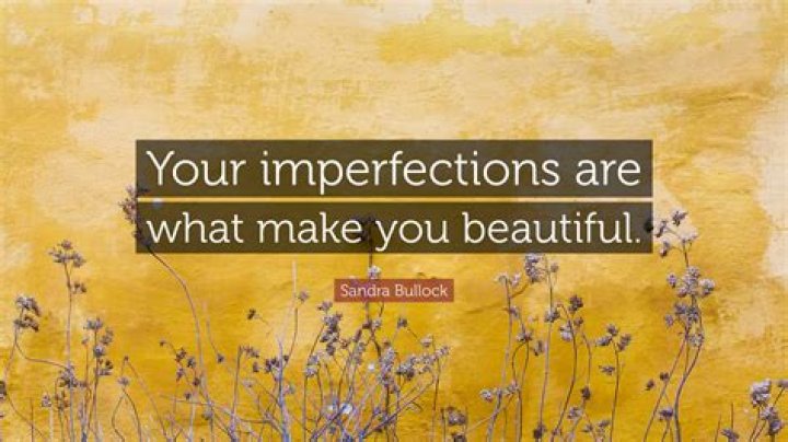 Why do imperfections make you beautiful?