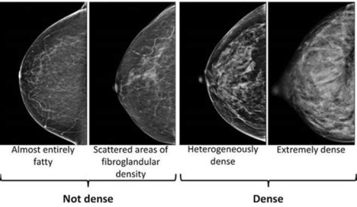 Why do my breasts itch after implants?