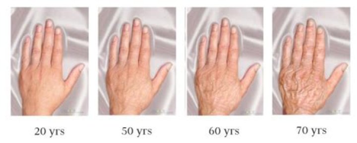 Why do my hands look so old and wrinkled?