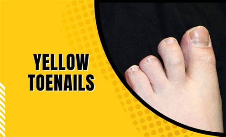 Why do old people's toenails turn yellow?