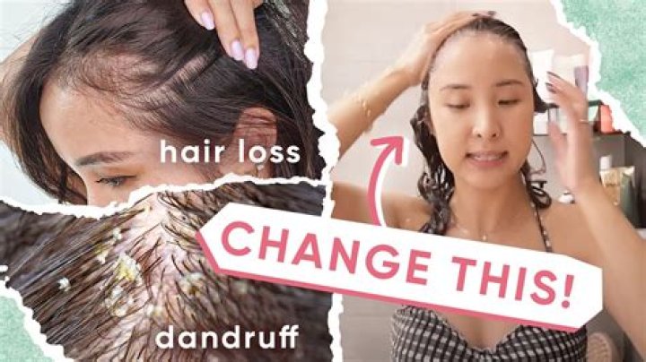 Why does my hair itch under my wig?