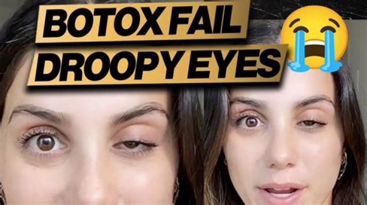Why does ptosis surgery fail?
