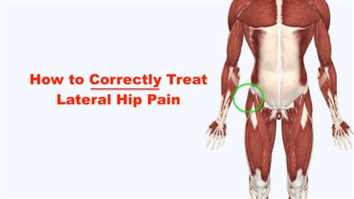 Why does the outside of my hip hurt?