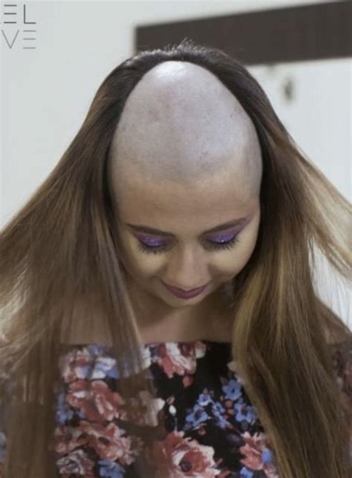 Why is Eleven's head shaved?