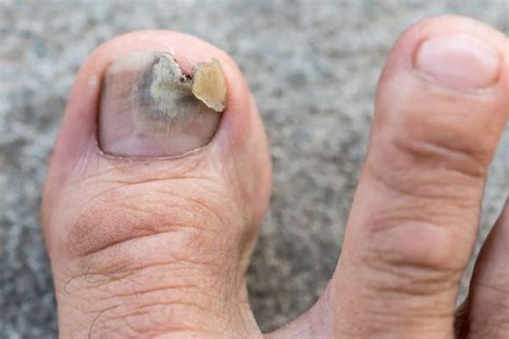 Why is it so hard to get lean?