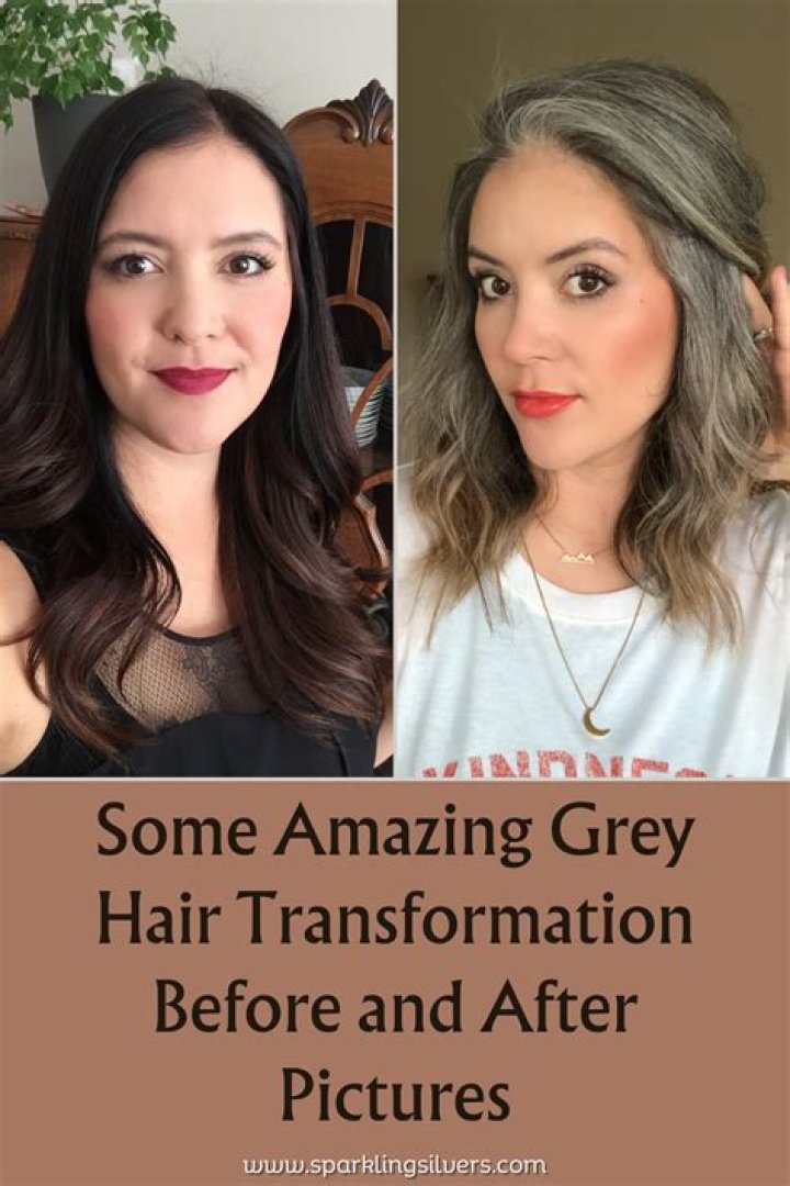 Why is my hair going grey so fast?