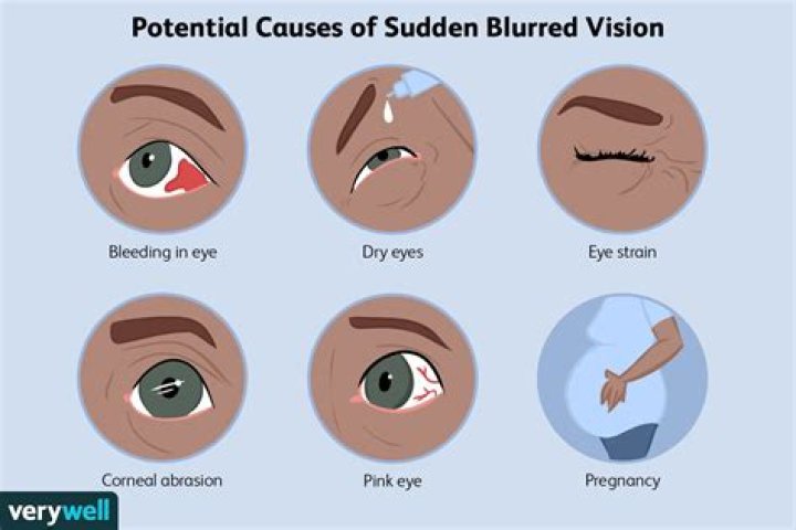 Why is my left eye blurry?