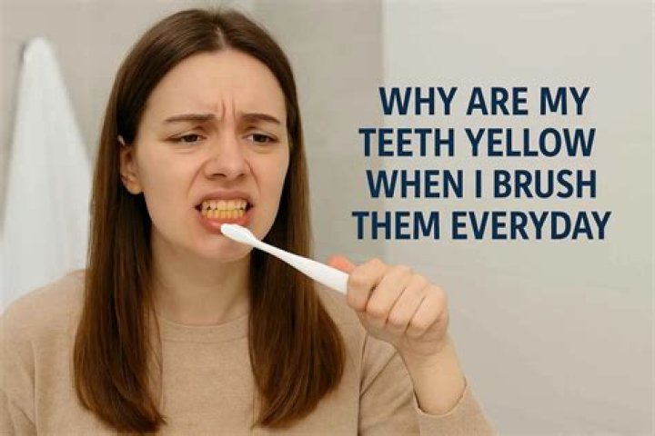 Why is my tongue yellow even though I brush it?