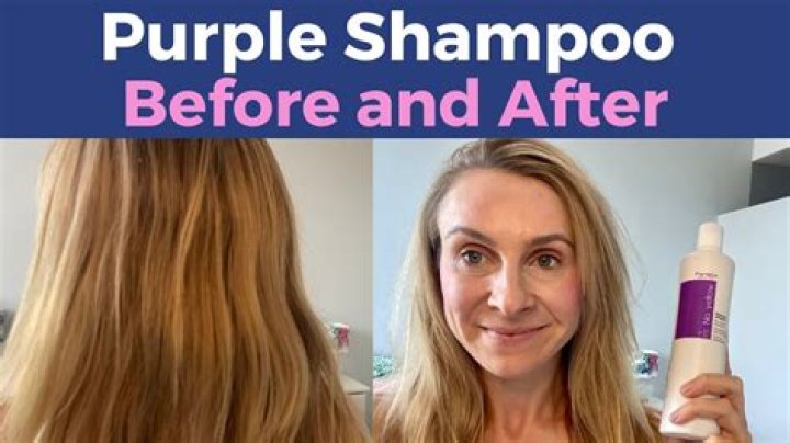 Will purple shampoo get rid of red tones?
